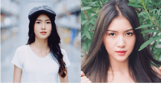 รีวิวเสริมคาง คุณใบชา