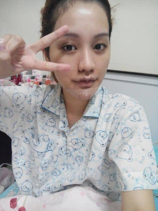 173709i6hyhy1fom79f8m6.jpg.thumb_ ศัลยกรรมจมูก ทำนม หมอนพรัตน์