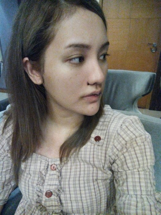 175743uf5d4dmdueeo1jmu.jpg.thumb_ ศัลยกรรมจมูก ทำนม หมอนพรัตน์