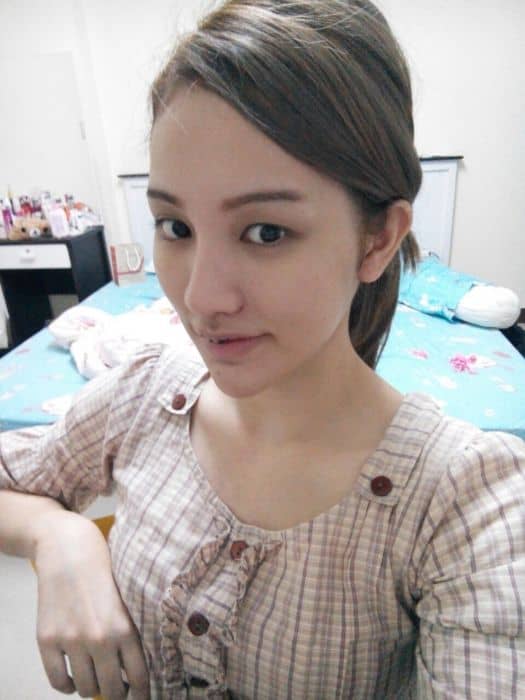 175822oxe4g4jsjfjwwgf0.jpg.thumb_ ศัลยกรรมจมูก ทำนม หมอนพรัตน์