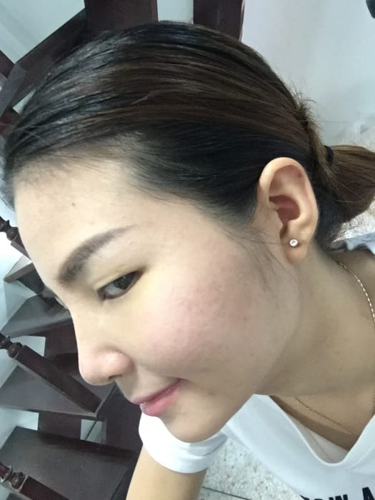 10 ศัลยกรรมจมูก ทำนม หมอนพรัตน์