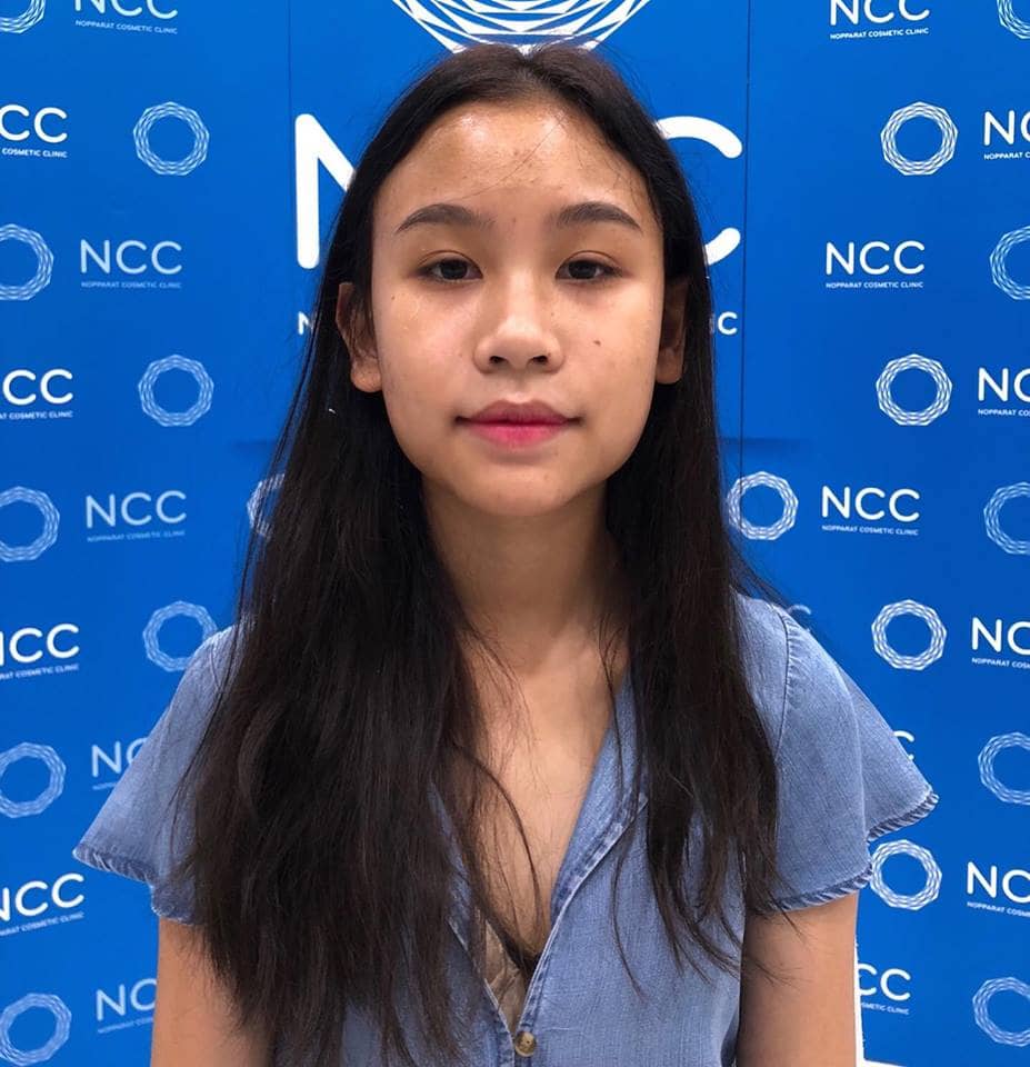583082415052816384_n ศัลยกรรมจมูก ทำนม หมอนพรัตน์