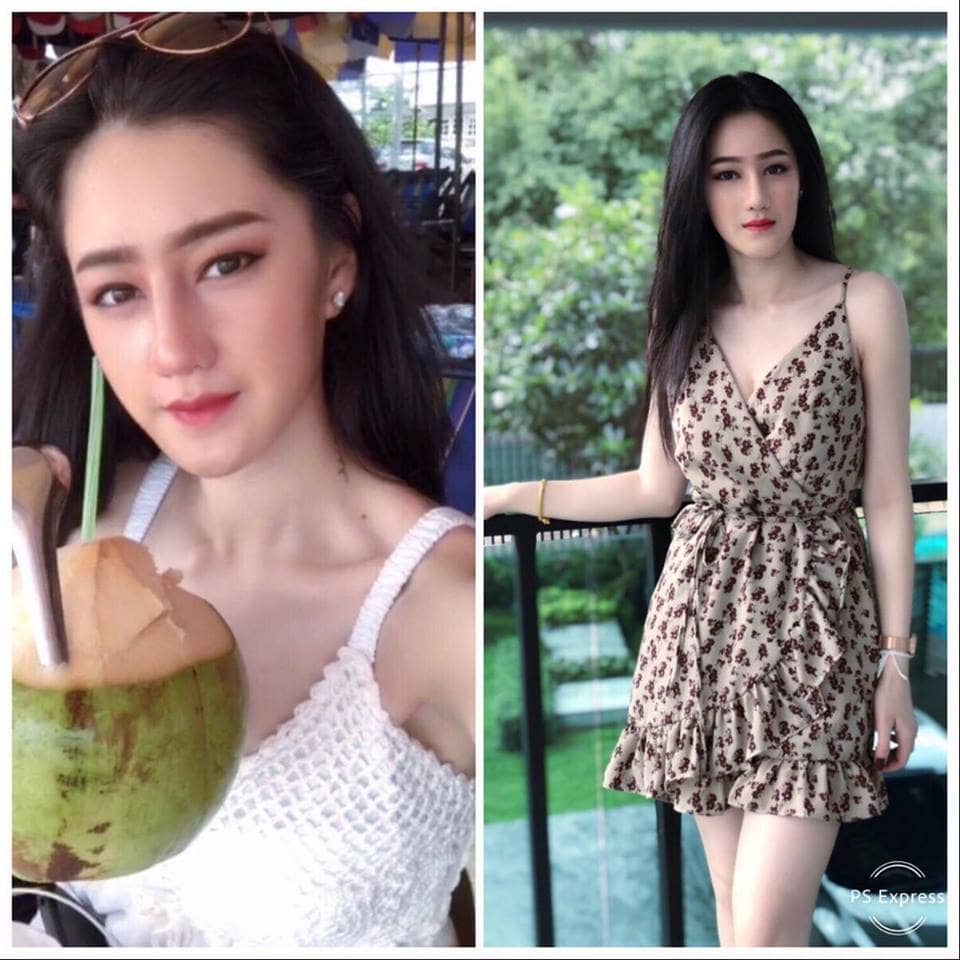 4019141730291941376_n ศัลยกรรมจมูก ทำนม หมอนพรัตน์