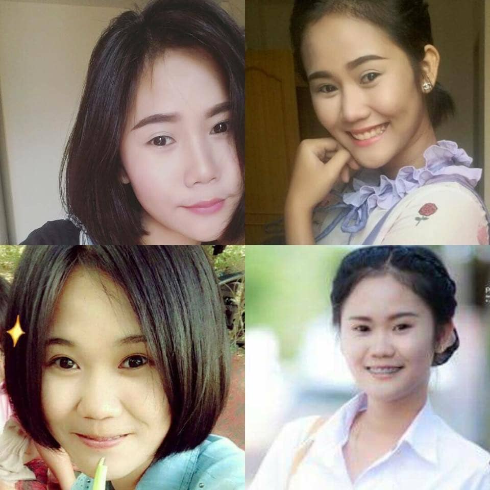 7637810530514032462_n ศัลยกรรมจมูก ทำนม หมอนพรัตน์
